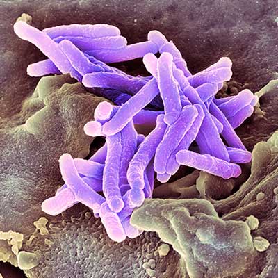 mycobacterium