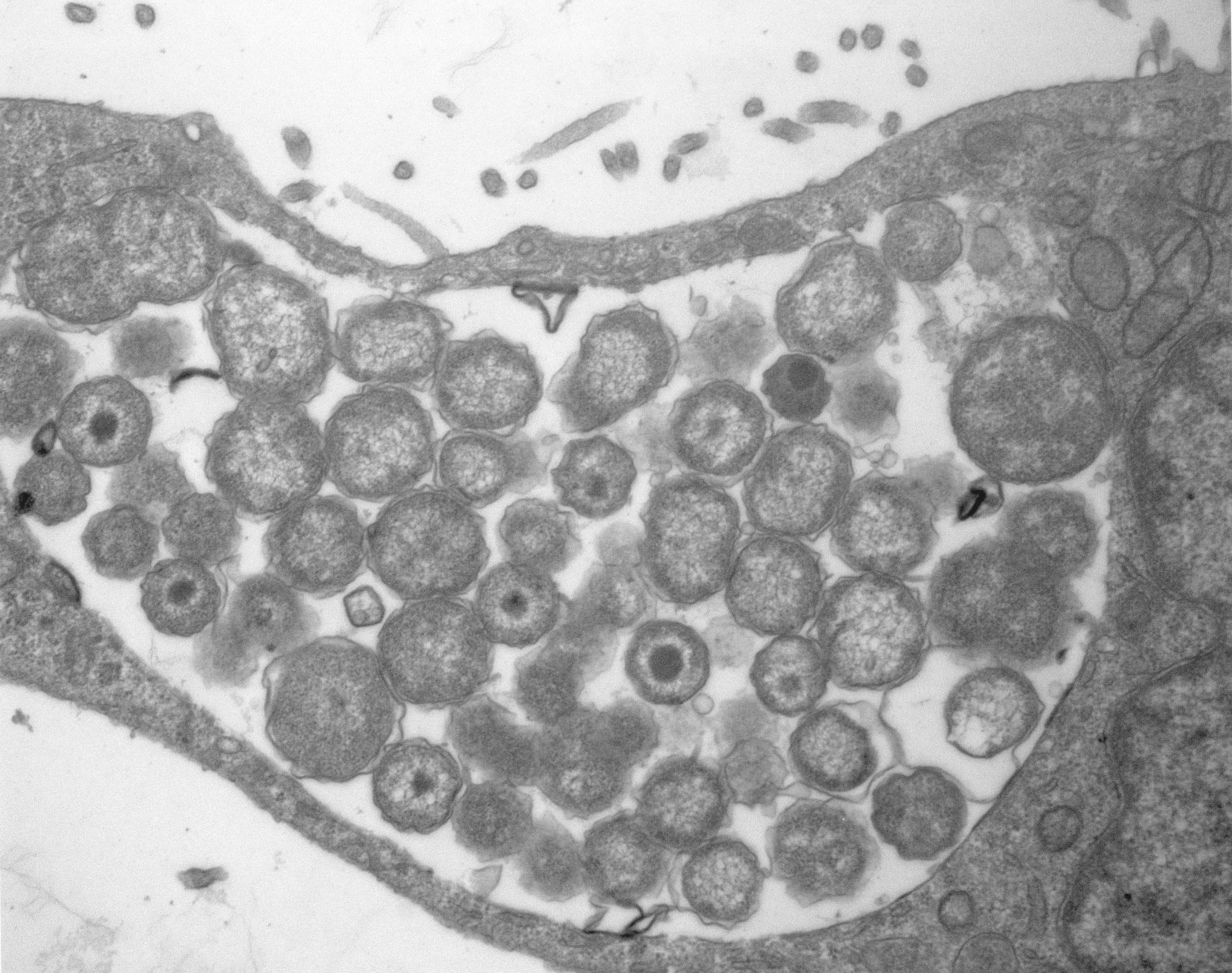 chlamydia trachomatis.jpg