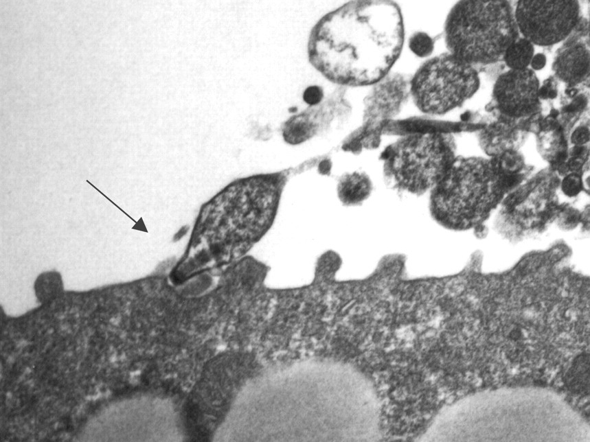 mycoplasma3.jpg